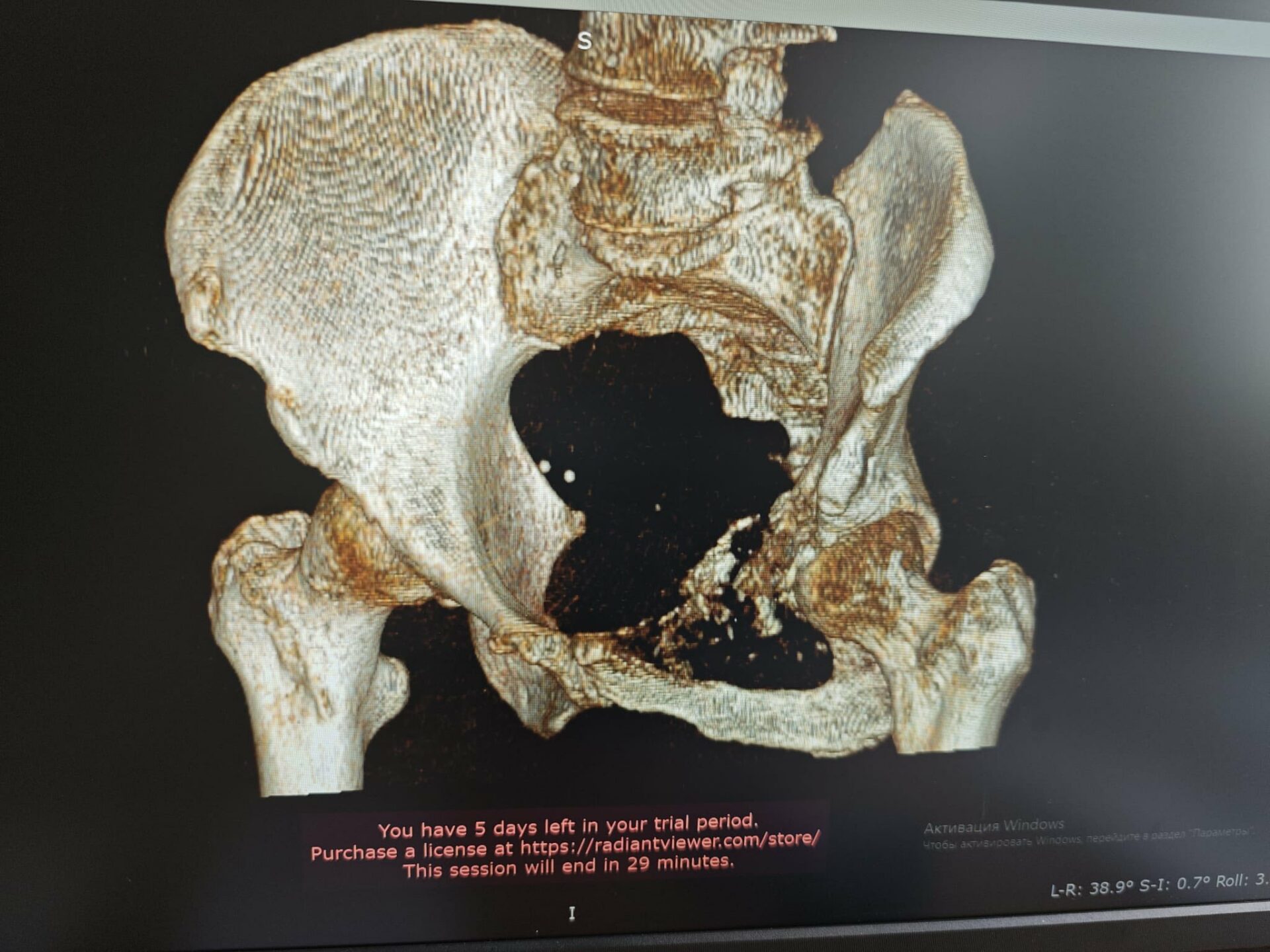 O nouă etapă în chirurgia oncologică reconstructivă din Republica Moldova