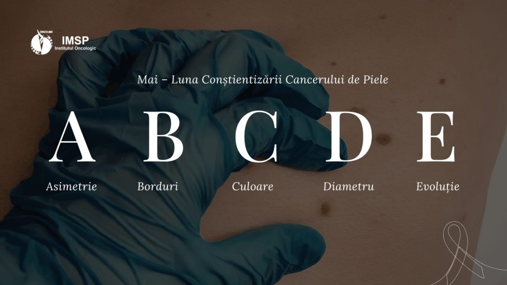 Luna mai – Luna Conștientizării Cancerului de Piele